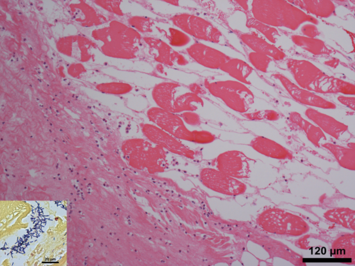 Histology of involved muscle – degenerate myocytes and an infiltrate of degenerate leukocytes in some areas of the lesion are typical. Close of up Gram stain shown in the insert.