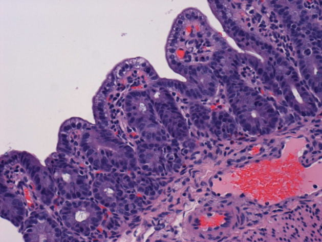 Marked atrophy and fusion of intestinal villi in piglet with PED.