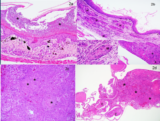 Surface keratin contains large numbers of fungal hyphae (*). The underlying epidermis is hyperplastic (200X, H & E). b. Multiple nodules and clusters of macrophages and giant cells (M), often containing fungal hyphae (see inset (400X, H & E) are within the expanded, fibrotic dermis and infiltrating into the underlying skeletal muscle (S) (100X, H & E). c, d. Granulomas occasionally containing fungal hyphae (*) within liver (c) and lung (d). Exudate (E) is accumulating in faveolar lumens 