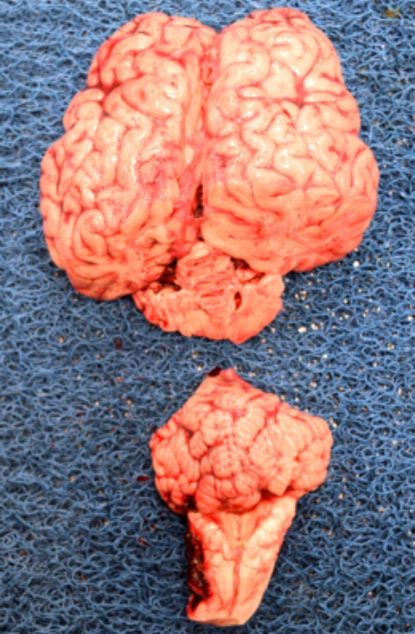 Brain removal in rostral and caudal sections. These may be sagittally sectioned, with half of each section fixed in formalin for histopathology, and the remaining halves stored fresh or frozen for  microbiologic tests