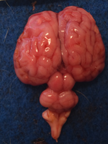 Cerebellar hypoplasia.