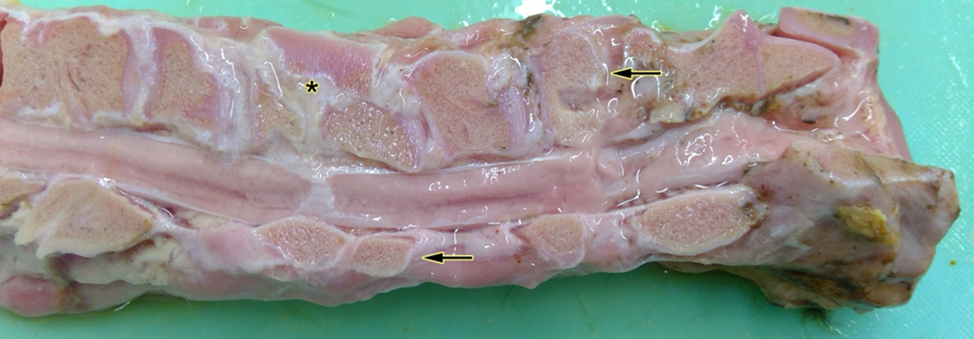 Mid-sagittal split vertebral column with irregular wedge-shaped C3-C7 cervical vertebral bodies 