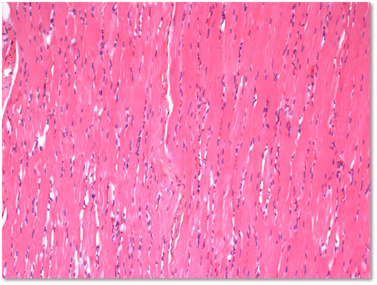 Normal skeletal muscle in age-matched nursery pig. Intact, happy myocytes.