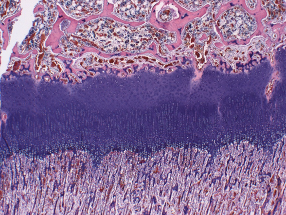 Distal femoral physis – normal (control) calf. Cartilage has an orderly arrangement and maturation sequence, with chondrocytes oriented in discrete parallel columns.