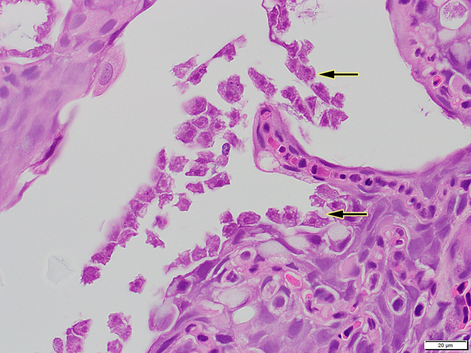 Figure 4. Histology of gills with amoebic trophozoites (arrows).