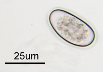 The characteristic ovoid Eimeria stiedae oocysts 