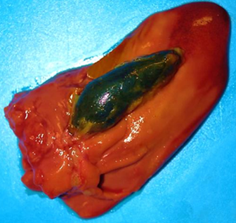 Liver, including intact gallbladder containing bile, is the preferred sample for C. hepaticus culture.