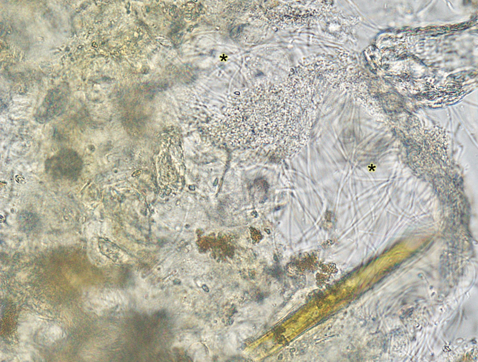 Figure 1. Gill clip wet mount with mats of slender filamentous bacteria (asterisks). 