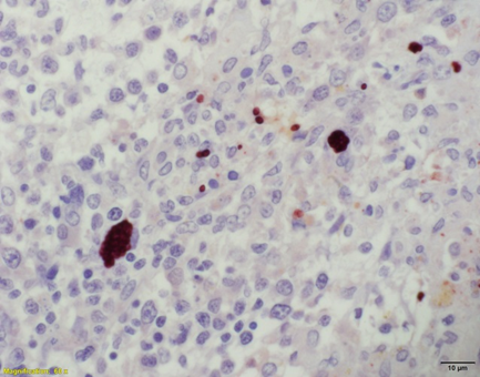 Figure 2. Spleen. Positive immunostaining of Toxoplasma gondii cysts and tachyzoites in the spleen. 600X