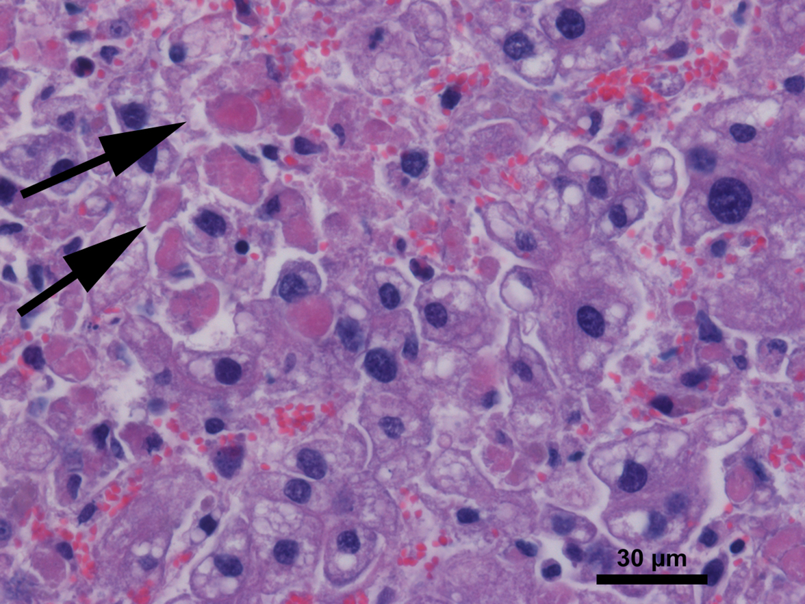 Liver, with necrosis of individual hepatocytes (arrows).