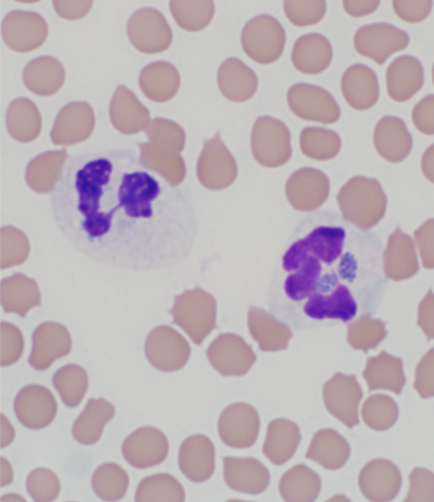 Two A. phagocytophilum morulae in a neutrophil. 