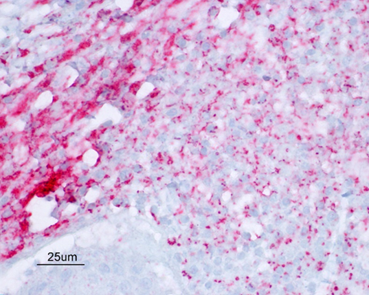 Positive IHC staining for Helicobacter spp. in ovine placenta.