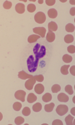 A. phagocytophilum morula in a neutrophil. 