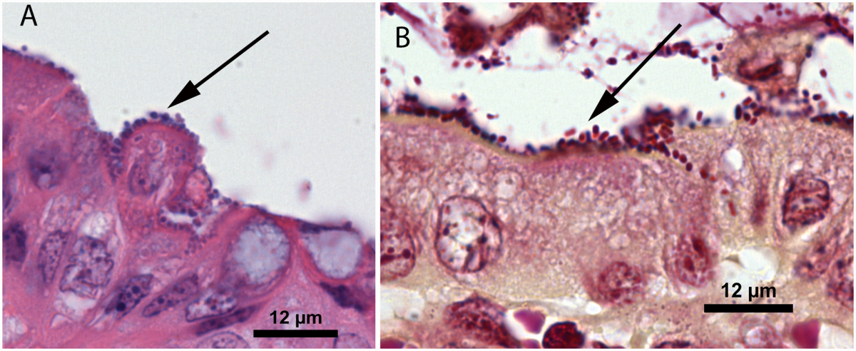 Figure 1A plump bacilli and 1B Gram stain