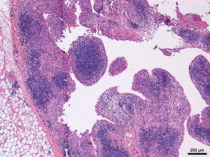 Marked proliferation of stifle synovium with extensive lymphoplasmacytic infiltrates.