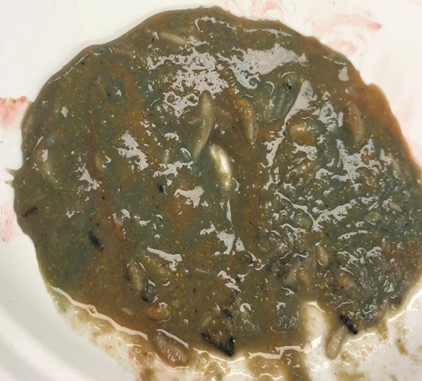 Stomach contents of a cat poisoned with methomyl. Note the blue-green discoloration of the stomach contents.