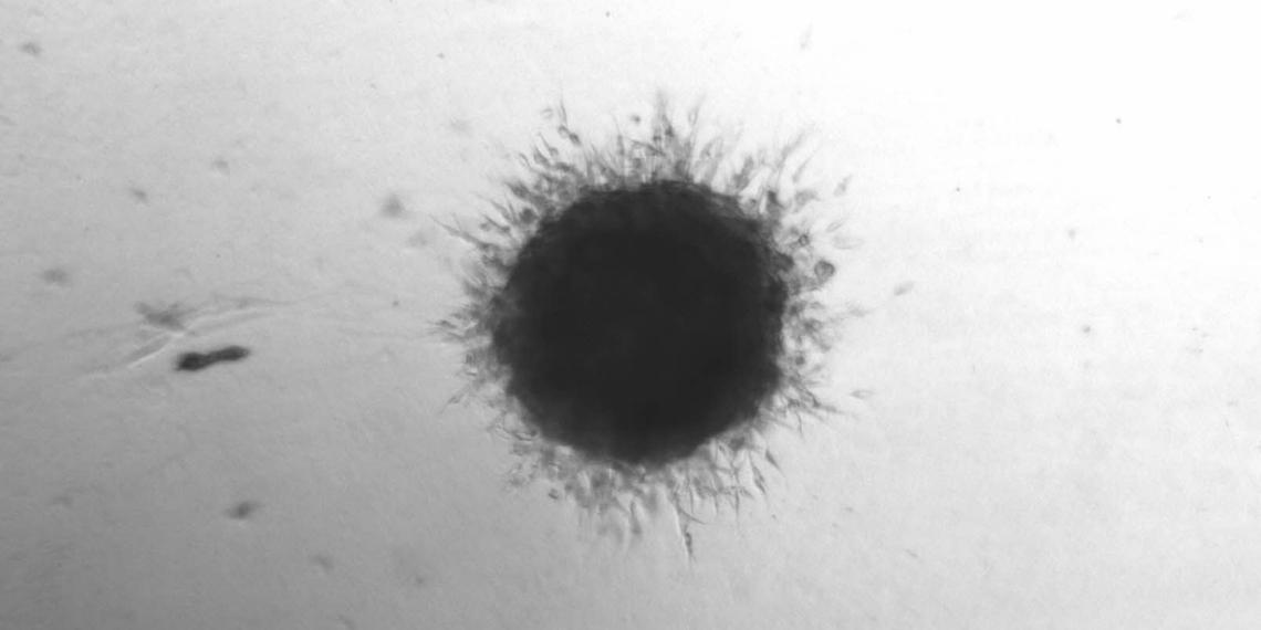 A mini three-dimensional tumour.