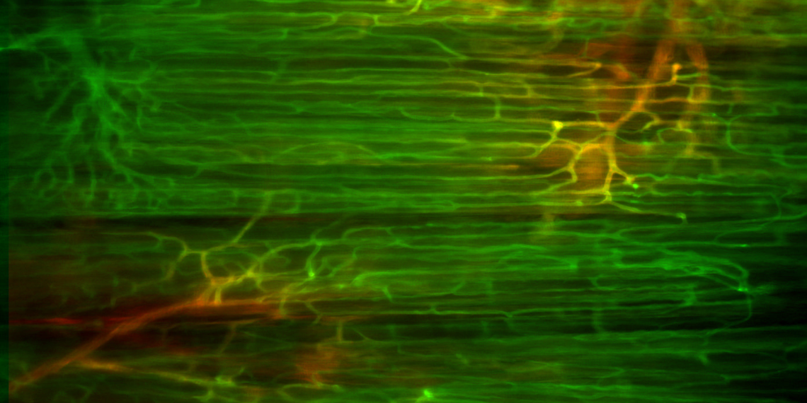 Capillaries under a microscope