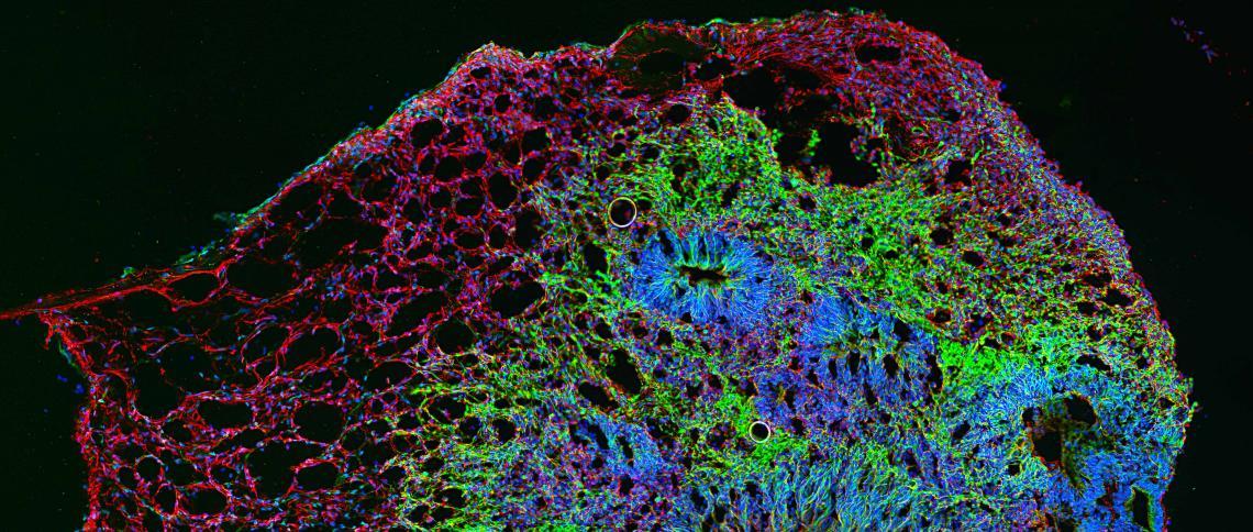 Microscopic image of a cross-section of a cerebral organoid