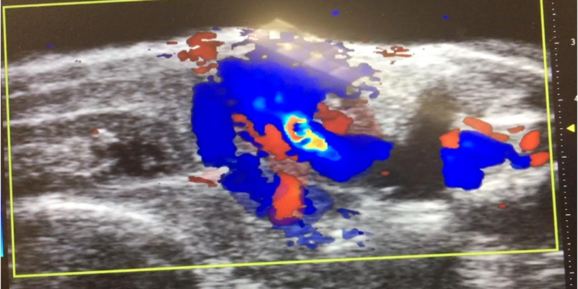 Ultrasound image of a zebrafish. All photos courtesy of Jared Shafto.