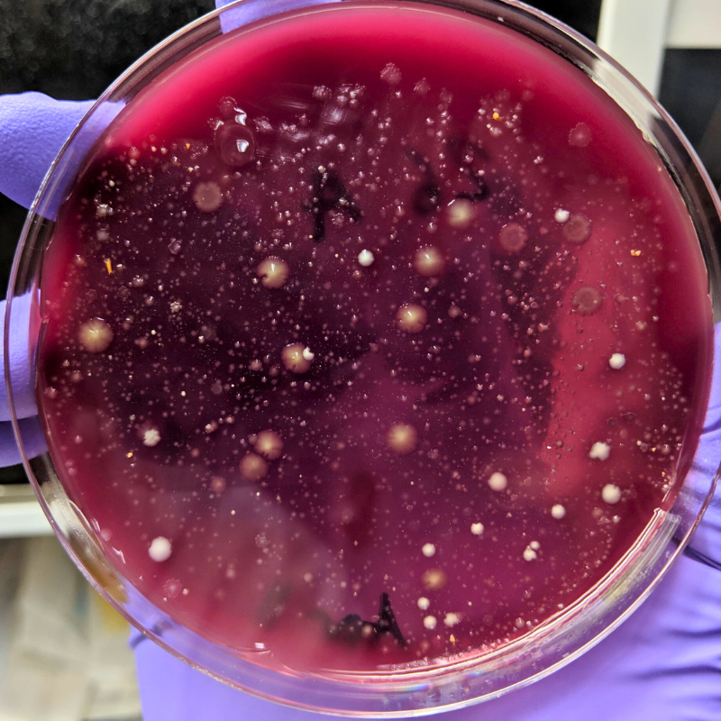 Petri dish showing microbiome