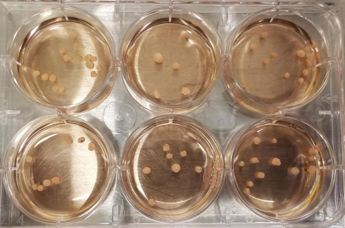 cerebral organoids