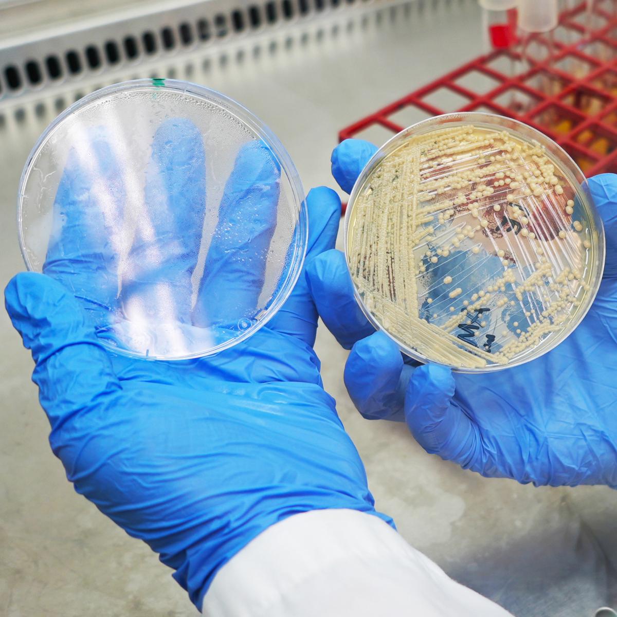 A petri dish streaked with fungi