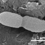 An Escherichia coli bacterium undergoing cell division (photo courtesy A. Berezuk)