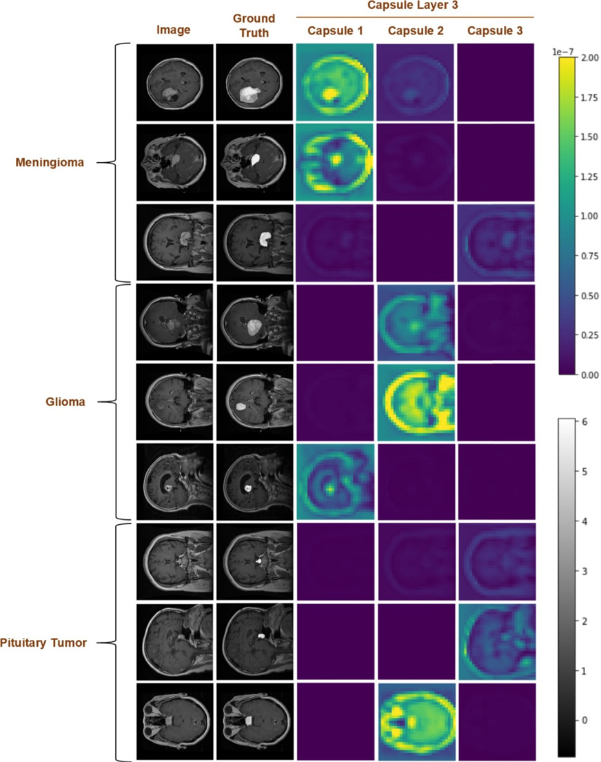Brain MRI images with ground truth tumour locations alongside RPV heatmaps for different tumour classes; brighter regions show what influenced the model, revealing attention on both tumours and non-relevant features like the skull outline or scan position.