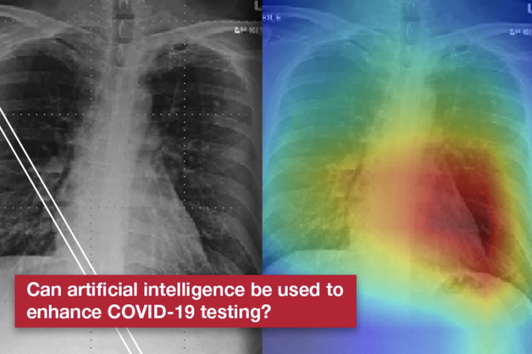 Xrays of person's lungs with text: Could AI be used to enhance COVID-19 testing?