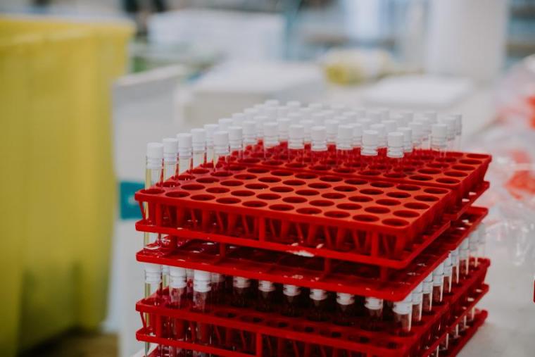 Photo of laboratory testing bench with test tubes