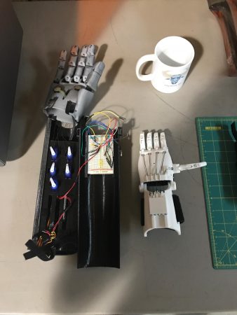 prosthetic arm