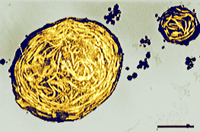 One large and one small fat globules showing their contents almost completely crystallized