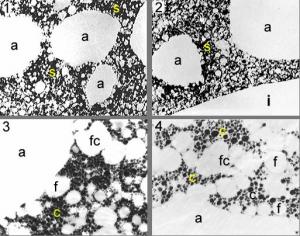 Cross sections of ice cream at low magnification as viewed by TEM after freeze substitution, showing the unfrozen serum phase (s), air bubbles (a), and an ice crystal (i)