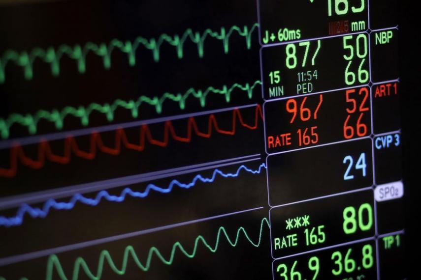 An image of a heart monitor trace