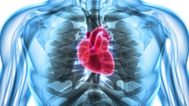 An X-ray image of a heart in a chest.