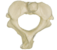 A photograph of the C2 Cervical Vertebrae.