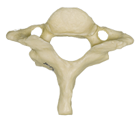 A photograph of the C7 Cervical Vertebrae.