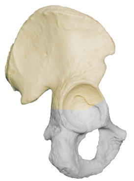A photograph of the Right Ilium.