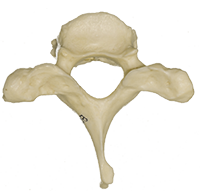 A photograph of the T1 Thoracic Vertebrae.