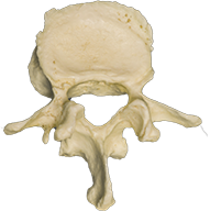 A photograph of the L3 Lumbar Vertebrae.