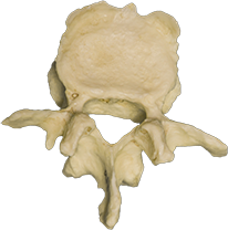 A photograph of the L4 Lumbar Vertebrae.