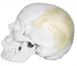 left parietal bone