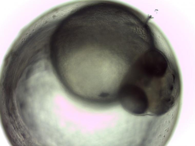 zebrafish embryo