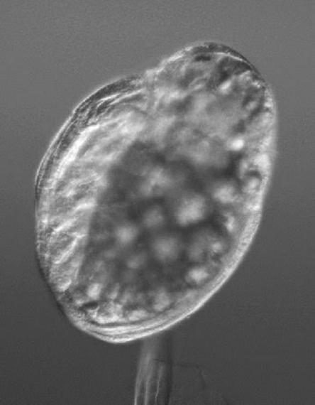 Daphnia embryo