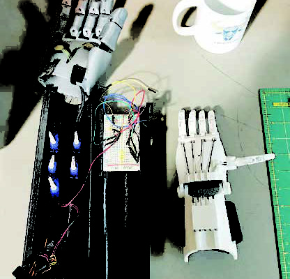 prosthetic hand