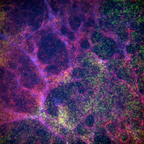 Pathogenic Pseudomonas aeruginosa cells (green) are shown grown as a biofilm in a flow cell reactor. The bacterial cells are surrounded by extracellular DNA (red) and polysaccharides (blue), which provide protection to the cells and lead to enhanced antibiotic resistance.