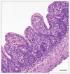 Histology of small intestine in a PED infected pig
