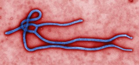 Photo of the ebola virus