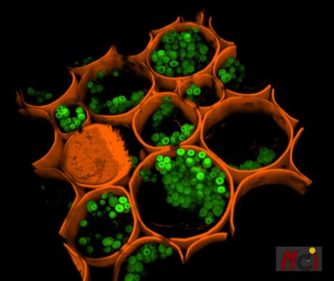 Image produced by Spinning Disk Confocal Microscope
